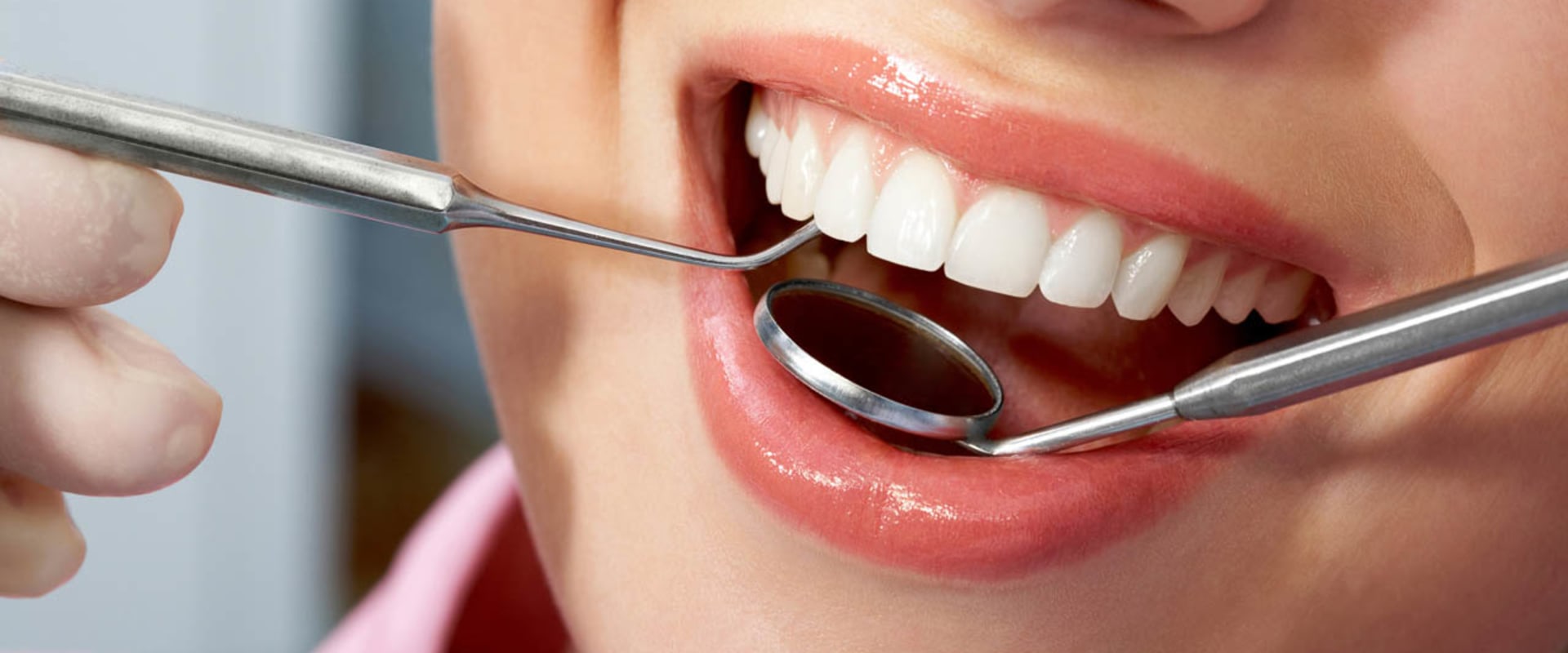 When Should You Repair a Chipped Tooth?
