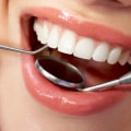 When Should You Repair a Chipped Tooth?
