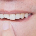 How to Repair Chip in The Teeth: A Comprehensive Guide