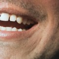 Is a Chipped Tooth Serious? Expert Advice on Treatment and Prevention