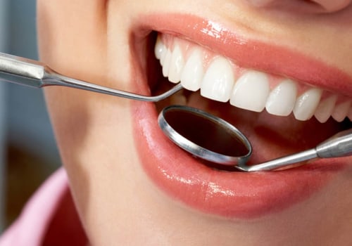 When Should You Repair a Chipped Tooth?